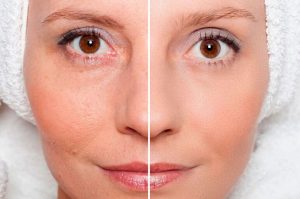 Lee más sobre el artículo Consejos para cuidar los poros de la piel